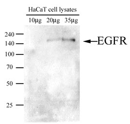 EGFR Antibody - Western Blot: Extracts of HaCaT were resolved by SDS-PAGE, transferred to PVDF membrane and probed with anti-human EGFR (1:250). Proteins were visualized using a goat anti-mouse secondary antibody conjugated to HRP and an ECL detection system.