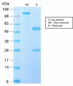 EGFR Antibody - SDS-PAGE Analysis Purified EGFRvIII Rabbit Recombinant Monoclonal Antibody (GFR/2600R). Confirmation of Purity and Integrity of Antibody.