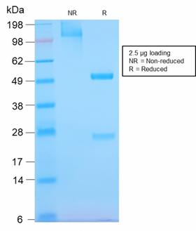 EGFR Antibody - SDS-PAGE Analysis Purified EGFR Rabbit Recombinant Monoclonal Antibody (GFR/2968R). Confirmation of Purity and Integrity of Antibody.