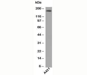 EGFR Antibody - Western blot testing of A431 lysate using EGFR antibody at 1ug/ml. This image was taken for the unmodified form of this product. Other forms have not been tested.