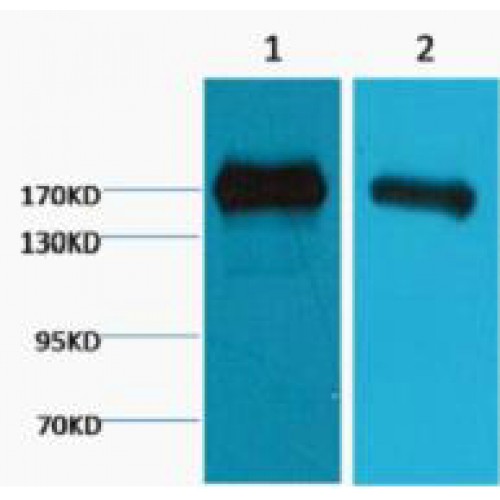 EGFR Antibody - Western blot of EGFR antibody