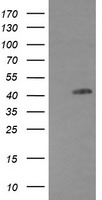 EGFR Antibody - HEK293T cells were transfected with the pCMV6-ENTRY control (Left lane) or pCMV6-ENTRY EGFR (Right lane) cDNA for 48 hrs and lysed. Equivalent amounts of cell lysates (5 ug per lane) were separated by SDS-PAGE and immunoblotted with anti-EGFR.