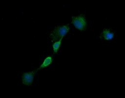 EGFR Antibody - Anti-EGFR mouse monoclonal antibody immunofluorescent staining of COS7 cells transiently transfected by pCMV6-ENTRY EGFR.