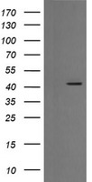 EGFR Antibody - HEK293T cells were transfected with the pCMV6-ENTRY control (Left lane) or pCMV6-ENTRY EGFR (Right lane) cDNA for 48 hrs and lysed. Equivalent amounts of cell lysates (5 ug per lane) were separated by SDS-PAGE and immunoblotted with anti-EGFR.