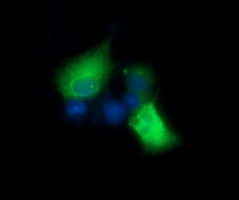 EGFR Antibody - Anti-EGFR mouse monoclonal antibody immunofluorescent staining of COS7 cells transiently transfected by pCMV6-ENTRY EGFR.