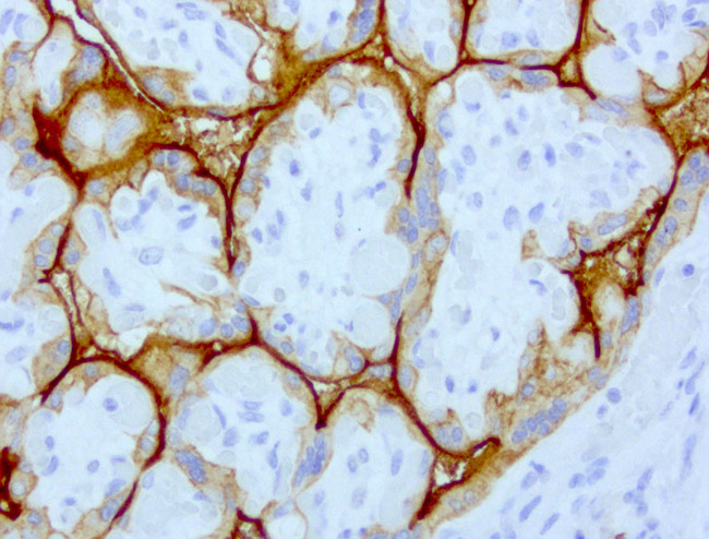 EGFR Antibody - Immunohistochemical staining of paraffin-embedded human placenta with mouse anti-EGFR clone UMAB95 1:200 dilution of 400ug/mL using HIER citrate pH6.o pressure chamber. Placenta known to express high levels in the cytoplasm and membrane trophoblastic cells