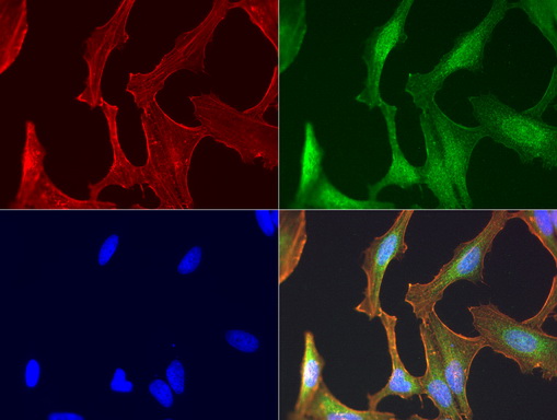 EGFR Antibody - Immunofluorescent staining of HeLa cells using anti-EGFR mouse monoclonal antibody  green, 1:50). Actin filaments were labeled with TRITC-phalloidin. (red), and nuclear with DAPI. (blue).