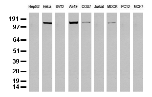 EGFR Antibody - Western blot analysis of extracts. (35ug) from 9 different cell lines by using anti-EGFR monoclonal antibody. (Clone UMAB95).