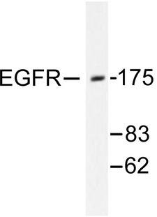 EGFR Antibody - Western blot of EGFR (H672) pAb in extracts from 293 cells treated with EGF 200ng/ml 30 mins.