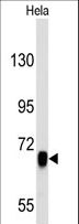 EGFR Antibody - Western blot of anti-EGFR antibody in HeLa cell line lysates (35 ug/lane). EGFR(arrow) was detected using the purified antibody.