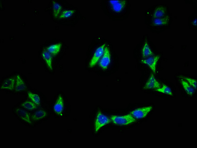 EGFR Antibody - Immunofluorescence staining of Hela cells with EGFR Antibody at 1:500, counter-stained with DAPI. The cells were fixed in 4% formaldehyde, permeabilized using 0.2% Triton X-100 and blocked in 10% normal Goat Serum. The cells were then incubated with the antibody overnight at 4°C. The secondary antibody was Alexa Fluor 488-congugated AffiniPure Goat Anti-Rabbit IgG(H+L).