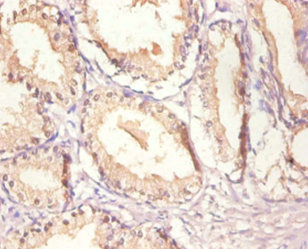 EGFR Antibody - Immunohistochemistry of paraffin-embedded human prostate tissue using EGFR Antibody at dilution of 1:100