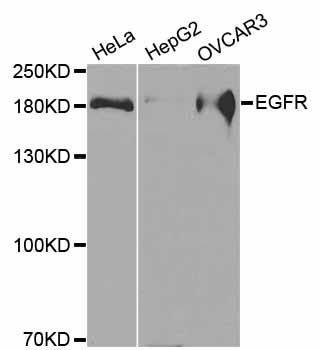 EGFR Antibody - Western blot analysis of extracts of various cell lines.