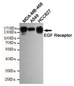 EGFR Antibody - Western blot detection of EGFR in HCC827, A549 and MDA-MB-468 cell lysates using EGFR mouse monoclonal antibody(dilution 1:1000). Predicted band size: 134 Kda. Observed band size:175KDa.