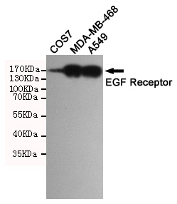 EGFR Antibody - Western blot detection of EGFR in A549, MDA-MB-468 and COS7 cell lysates using EGFR mouse monoclonal antibody(dilution 1:1000). Predicted band size: 134 Kda. Observed band size:175KDa.