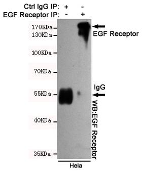 EGFR Antibody - Immunoprecipitation analysis of HeLa cell lysates using EGFR mouse monoclonal antibody.