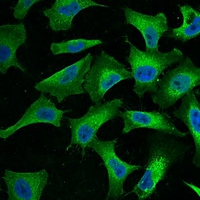 EGFR Antibody - Immunofluorescent analysis of EGFR staining in HeLa cells. Formalin-fixed cells were permeabilized with 0.1% Triton X-100 in TBS for 5-10 minutes and blocked with 3% BSA-PBS for 30 minutes at room temperature. Cells were probed with the primary antibody in 3% BSA-PBS and incubated overnight at 4 deg C in a humidified chamber. Cells were washed with PBST and incubated with a FITC-conjugated secondary antibody (green) in PBS at room temperature in the dark. DAPI was used to stain the cell nuclei (blue).