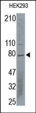 EGFR Antibody - The EGFR Isoform 3 Antibody is used in Western blot to detect EGFR Isoform 3 in HEK293 cell lysate.