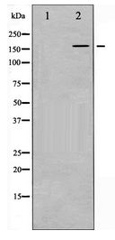 EGFR Antibody - Western blot of EGFR expression in A431 whole cell lysates,The lane on the left is treated with the antigen-specific peptide.