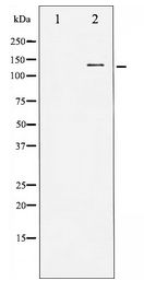 EGFR Antibody - Western blot of EGFR expression in Serum treated HUVEC whole cell lysates,The lane on the left is treated with the antigen-specific peptide.