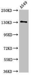 EGFR Antibody - Positive Western Blot detected in A549 whole cell lysate. All lanes: EGFR antibody at 2.5 µg/ml Secondary Goat polyclonal to rabbit IgG at 1/50000 dilution. Predicted band size: 135, 45, 78, 70 KDa. Observed band size: 135 KDa