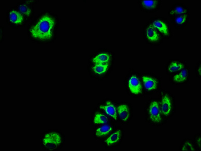 EGFR Antibody - Immunofluorescence staining of HepG2 cells with EGFR Antibody at 1:166, counter-stained with DAPI. The cells were fixed in 4% formaldehyde, permeabilized using 0.2% Triton X-100 and blocked in 10% normal Goat Serum. The cells were then incubated with the antibody overnight at 4°C. The secondary antibody was Alexa Fluor 488-congugated AffiniPure Goat Anti-Rabbit IgG(H+L).