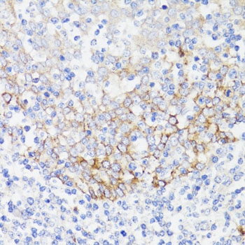 EGFR Antibody - Immunohistochemistry of paraffin-embedded human tonsil using EGFR antibody at dilution of 1:150 (40x lens).