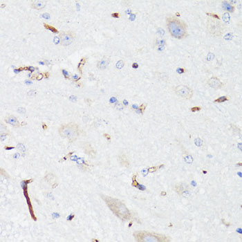 EGFR Antibody - Immunohistochemistry of paraffin-embedded mouse spinal cord endothelial cells using EGFR antibody at dilution of 1:150 (40x lens).