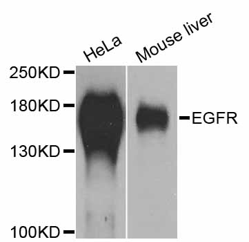 EGFR Antibody - Western blot analysis of extracts of various cell lines, using EGFR antibody at 1:1000 dilution. The secondary antibody used was an HRP Goat Anti-Rabbit IgG (H+L) at 1:10000 dilution. Lysates were loaded 25ug per lane and 3% nonfat dry milk in TBST was used for blocking. An ECL Kit was used for detection and the exposure time was 30s.