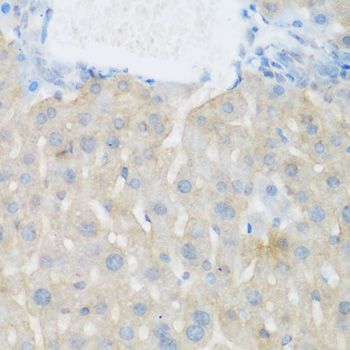 EGFR Antibody - Immunohistochemistry of paraffin-embedded mouse liver using EGFR antibody at dilution of 1:100 (40x lens).