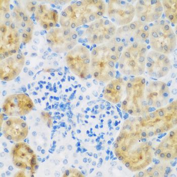 EGFR Antibody - Immunohistochemistry of paraffin-embedded mouse kidney using EGFR antibody at dilution of 1:100 (40x lens).