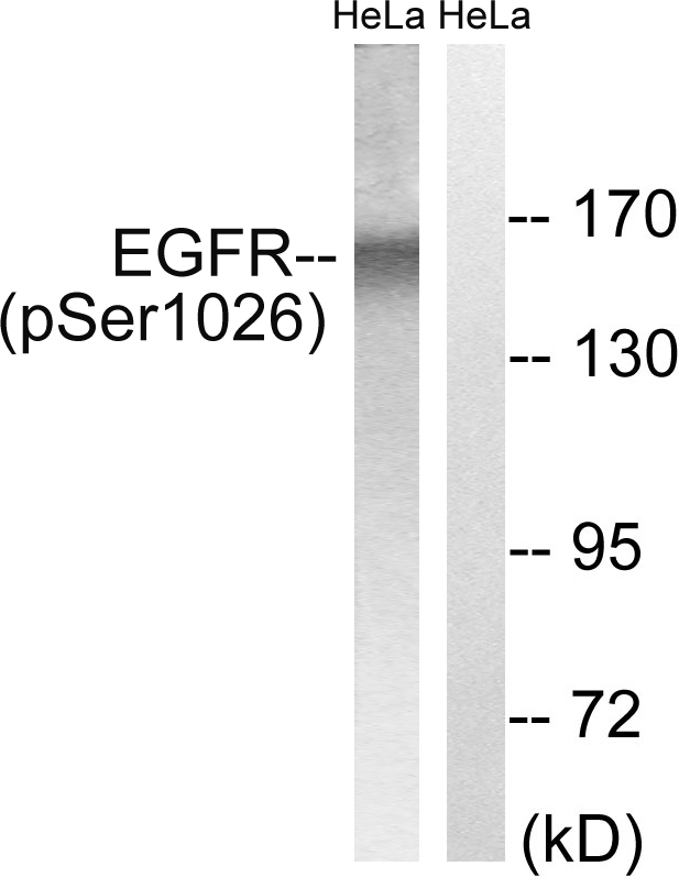 EGFR Antibody - Western blot analysis of lysates from HeLa cells treated with TSA 400nM 24H, using EGFR (Phospho-Ser1026) Antibody. The lane on the right is blocked with the phospho peptide.