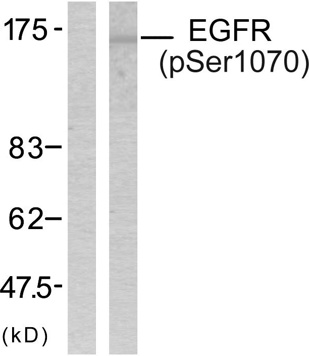 EGFR Antibody - Western blot analysis of lysates from SK-OV3 cells treated with EGF, using EGFR (Phospho-Ser1070) Antibody. The lane on the left is blocked with the phospho peptide.