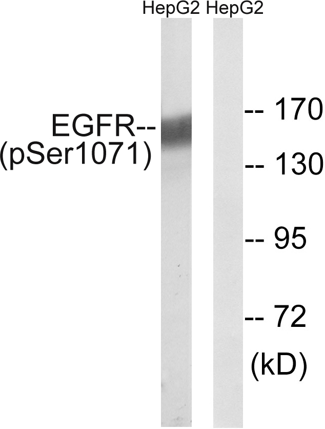 EGFR Antibody - Western blot analysis of lysates from HepG2 cells treated with serum 20% 15', using EGFR (Phospho-Ser1071) Antibody. The lane on the right is blocked with the phospho peptide.