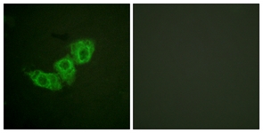 EGFR Antibody - Immunofluorescence of HUVEC cells, using EGFR (Phospho-Thr678) Antibody. The sample on the right was incubated with synthetic peptide.