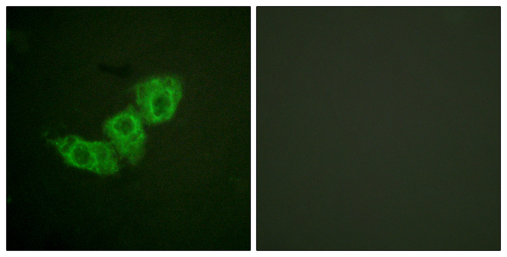 EGFR Antibody - Immunofluorescence analysis of HUVEC cells, using EGFR (Phospho-Thr678) Antibody. The picture on the right is blocked with the phospho peptide.