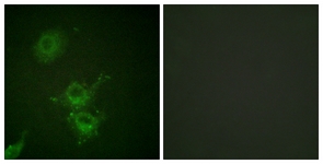 EGFR Antibody - Immunofluorescence of HUVEC cells, using EGFR (Phospho-Thr693) Antibody. The sample on the right was incubated with synthetic peptide.