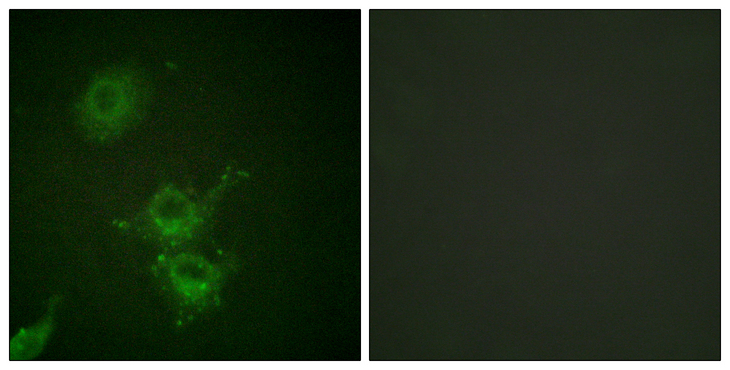 EGFR Antibody - Immunofluorescence analysis of HUVEC cells, using EGFR (Phospho-Thr693) Antibody. The picture on the right is blocked with the phospho peptide.