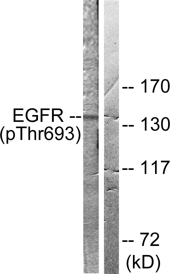 EGFR Antibody - Western blot analysis of lysates from A431 cells, using EGFR (Phospho-Thr693) Antibody. The lane on the right is blocked with the phospho peptide.