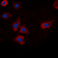 EGFR Antibody - Immunofluorescent analysis of EGFR (pT693) staining in HEK293T cells. Formalin-fixed cells were permeabilized with 0.1% Triton X-100 in TBS for 5-10 minutes and blocked with 3% BSA-PBS for 30 minutes at room temperature. Cells were probed with the primary antibody in 3% BSA-PBS and incubated overnight at 4 deg C in a humidified chamber. Cells were washed with PBST and incubated with a DyLight 594-conjugated secondary antibody (red) in PBS at room temperature in the dark. DAPI was used to stain the cell nuclei (blue).