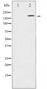 EGFR Antibody - Western blot of EGFR phosphorylation expression in A431 whole cell lysates,The lane on the left is treated with the antigen-specific peptide.
