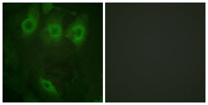 EGFR Antibody - Immunofluorescence analysis of HeLa cells, using EGFR (Phospho-Tyr1016) Antibody. The picture on the right is blocked with the phospho peptide.