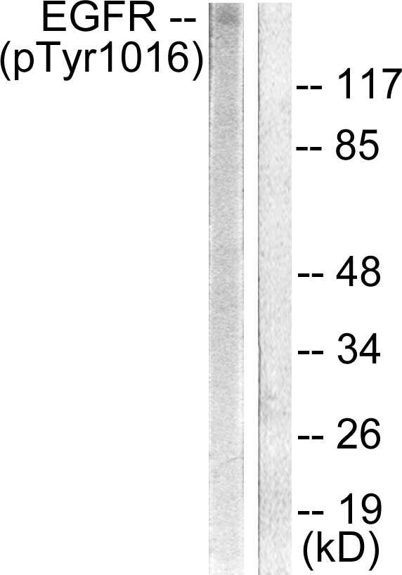 EGFR Antibody - Western blot analysis of lysates from HUVEC cells treated with Serum 20% 30', using EGFR (Phospho-Tyr1016) Antibody. The lane on the right is blocked with the phospho peptide.