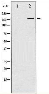 EGFR Antibody - Western blot of EGFR phosphorylation expression in Serum treated HUVEC whole cell lysates,The lane on the left is treated with the antigen-specific peptide.