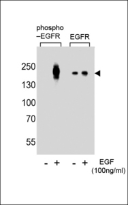 EGFR Antibody - Western blot of lysate from A431 cells(from left to right),untreated or treated with EGF at 100ng/ml,using Phospho-EGFR-pY1016 Antibody or EGFR-pS695 Antibody.Lysate at 15ug per lane.Antibody was diluted at 1:8000 dilution at each lane. A goat anti-rabbit IgG H&L (HRP) at 1:5000 dilution was used as the secondary antibody.