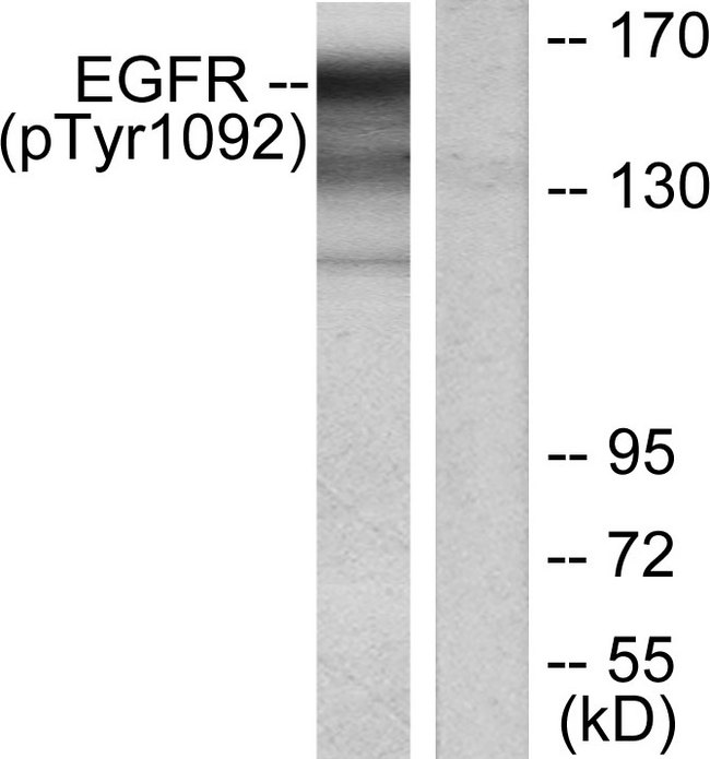 EGFR Antibody - Western blot analysis of lysates from HUVEC cells treated with EGF, using EGFR (Phospho-Tyr1092) Antibody. The lane on the right is blocked with the phospho peptide.