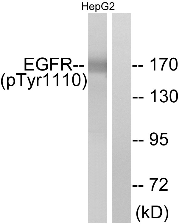 EGFR Antibody - Western blot analysis of lysates from HepG2 cells, using EGFR (Phospho-Tyr1110) Antibody. The lane on the right is blocked with the phospho peptide.