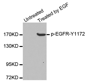 EGFR Antibody - Western blot analysis of extracts from A431 cells.