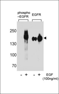EGFR Antibody - Western blot of extracts from A431 cells,untreated or treated with EGF using Phospho-EGFR(Tyr1172)(left) or EGFR antibody(right).