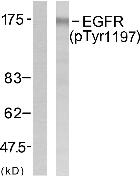 EGFR Antibody - Western blot analysis of lysates from A431 cells treated with EGF 40 muM 10', using EGFR (Phospho-Tyr1197) Antibody. The lane on the left is blocked with the phospho peptide.